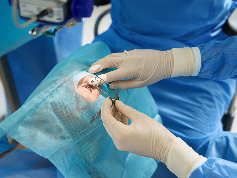 Eyelid Surgery in Siliguri